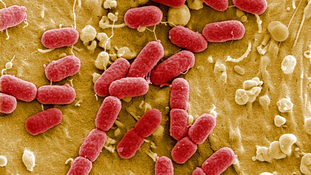 Drug-resistant superbugs projected to kill 39 million by 2050