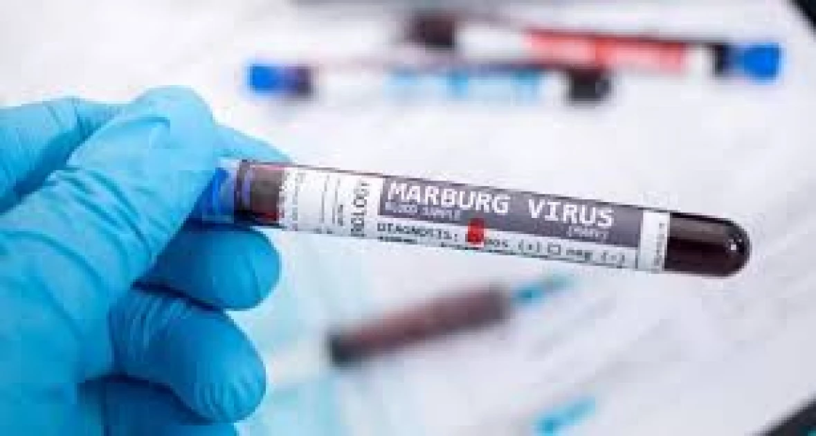 Toll in Rwanda Marburg outbreak rises to 11