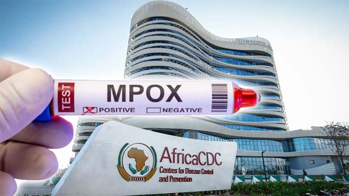 Africa CDC endorses first locally made mpox test