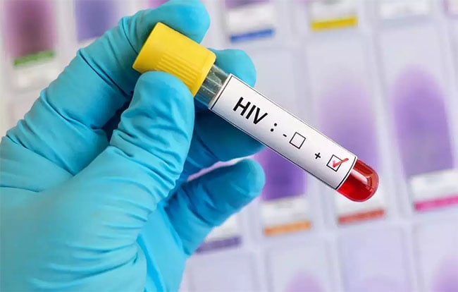 'Remarkable global progress': HIV cases and deaths declining